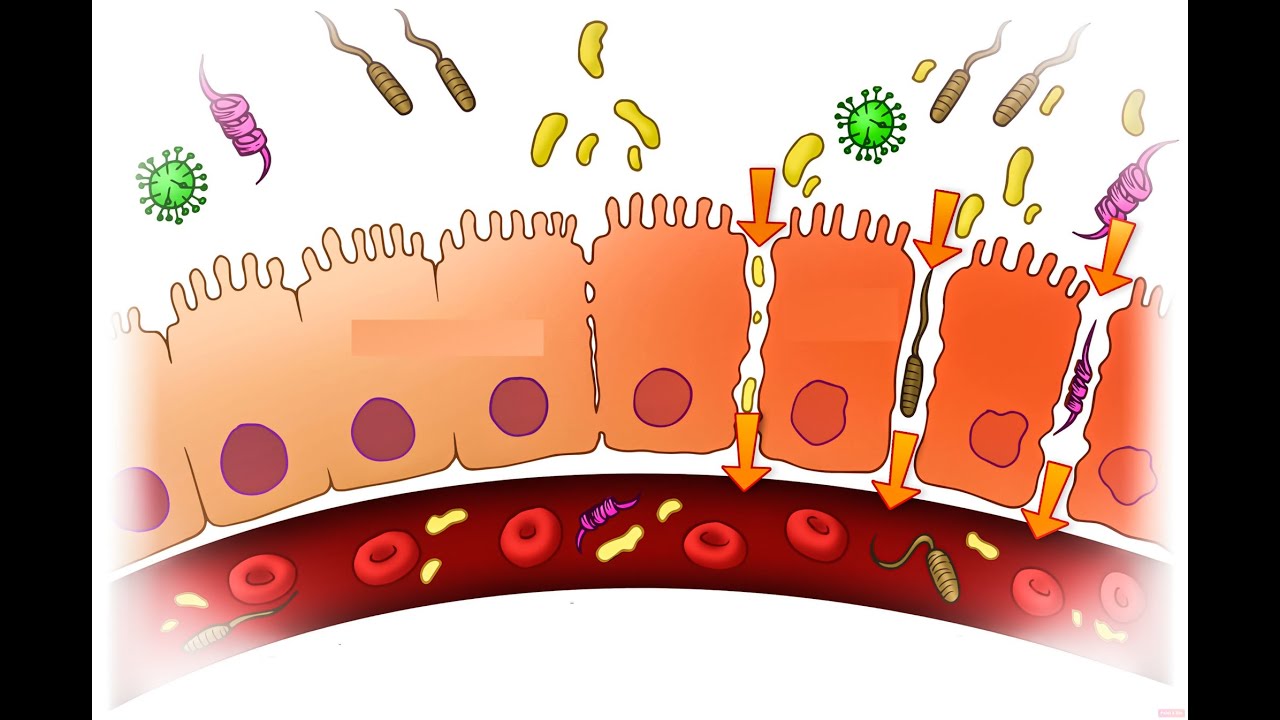 Inflamaci N De Bajo Grado C Mo Puede Afectar Nuestra Salud Rewell